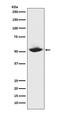 Matrix Metallopeptidase 1 antibody, M00733, Boster Biological Technology, Western Blot image 