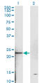 Troponin I2, Fast Skeletal Type antibody, LS-C198355, Lifespan Biosciences, Western Blot image 