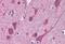 Signal Transducing Adaptor Family Member 2 antibody, GTX89679, GeneTex, Immunohistochemistry paraffin image 