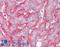 Ectonucleotide Pyrophosphatase/Phosphodiesterase 1 antibody, LS-B2335, Lifespan Biosciences, Immunohistochemistry frozen image 