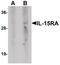 Interleukin 15 Receptor Subunit Alpha antibody, PA5-34512, Invitrogen Antibodies, Western Blot image 