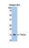 Olfactomedin 4 antibody, LS-C300762, Lifespan Biosciences, Western Blot image 