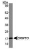 Teratocarcinoma-Derived Growth Factor 1 antibody, PA1-16533, Invitrogen Antibodies, Western Blot image 