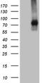 Transforming Growth Factor Beta Receptor 2 antibody, CF807912, Origene, Western Blot image 
