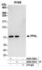 Phosphofructokinase, Liver Type antibody, A304-320A, Bethyl Labs, Immunoprecipitation image 