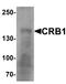 Crumbs Cell Polarity Complex Component 1 antibody, orb179047, Biorbyt, Western Blot image 