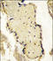 IMP-3 antibody, LS-C100059, Lifespan Biosciences, Immunohistochemistry frozen image 