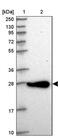 Coiled-Coil-Helix-Coiled-Coil-Helix Domain Containing 6 antibody, PA5-61567, Invitrogen Antibodies, Western Blot image 