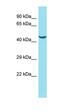 N-Acetyltransferase Domain Containing 1 antibody, orb326888, Biorbyt, Western Blot image 