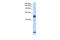 Splicing Factor 3b Subunit 6 antibody, 29-428, ProSci, Enzyme Linked Immunosorbent Assay image 