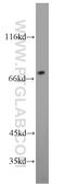 MPD antibody, 15331-1-AP, Proteintech Group, Western Blot image 