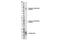 ROS Proto-Oncogene 1, Receptor Tyrosine Kinase antibody, 3078S, Cell Signaling Technology, Western Blot image 