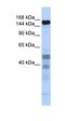 Zinc Finger Protein 335 antibody, orb324805, Biorbyt, Western Blot image 