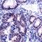 MutS Homolog 2 antibody, MA5-16379, Invitrogen Antibodies, Immunohistochemistry paraffin image 