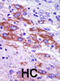 Casein Kinase 1 Delta antibody, abx033376, Abbexa, Immunohistochemistry paraffin image 