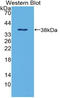 Defensin Beta 1 antibody, LS-C293660, Lifespan Biosciences, Western Blot image 