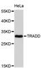 TNFRSF1A Associated Via Death Domain antibody, STJ110930, St John