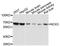 NADPH Oxidase 3 antibody, STJ26439, St John