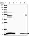 ATP5A antibody, PA5-56630, Invitrogen Antibodies, Western Blot image 