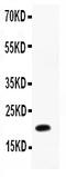 Interleukin 12B antibody, RP1028, Boster Biological Technology, Western Blot image 