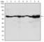 Coactivator Associated Arginine Methyltransferase 1 antibody, abx011384, Abbexa, Western Blot image 