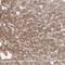 Matrix Metallopeptidase 2 antibody, HPA001939, Atlas Antibodies, Immunohistochemistry paraffin image 