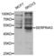 Serpin Family A Member 3 antibody, abx000963, Abbexa, Western Blot image 