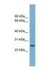 Protein lin-37 homolog antibody, NBP1-57638, Novus Biologicals, Western Blot image 