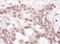 THO Complex 1 antibody, NBP1-47304, Novus Biologicals, Immunohistochemistry paraffin image 