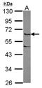 Coronin 2B antibody, NBP2-15969, Novus Biologicals, Western Blot image 