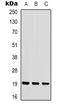 Stathmin 1 antibody, orb338846, Biorbyt, Western Blot image 