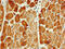 Phosphatidylinositol 3-Kinase Catalytic Subunit Type 3 antibody, CSB-PA854108LA01HU, Cusabio, Immunohistochemistry paraffin image 