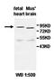 ATP Binding Cassette Subfamily D Member 2 antibody, orb77538, Biorbyt, Western Blot image 
