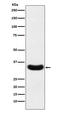 Phospholipid Scramblase 1 antibody, M02995-1, Boster Biological Technology, Western Blot image 