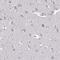 Heparan Sulfate 2-O-Sulfotransferase 1 antibody, NBP1-91982, Novus Biologicals, Immunohistochemistry frozen image 