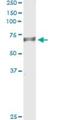 ER Degradation Enhancing Alpha-Mannosidase Like Protein 2 antibody, H00055741-M01, Novus Biologicals, Immunoprecipitation image 