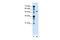 Zinc Finger FYVE-Type Containing 27 antibody, PA5-42569, Invitrogen Antibodies, Western Blot image 