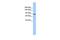 Adaptor Related Protein Complex 2 Subunit Beta 1 antibody, GTX45496, GeneTex, Western Blot image 