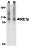 Serine/threonine-protein kinase/endoribonuclease IRE1 antibody, PA5-20191, Invitrogen Antibodies, Western Blot image 