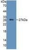 Protein Tyrosine Phosphatase Receptor Type F antibody, abx131516, Abbexa, Western Blot image 