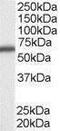 DEAD-Box Helicase 5 antibody, PA1-31019, Invitrogen Antibodies, Western Blot image 