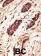 Matrix Metallopeptidase 10 antibody, abx032723, Abbexa, Immunohistochemistry paraffin image 