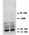 Fibroblast Growth Factor 2 antibody, LS-C171561, Lifespan Biosciences, Western Blot image 