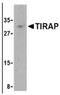 TIR Domain Containing Adaptor Protein antibody, AP05227PU-N, Origene, Western Blot image 