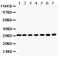 Catechol-O-Methyltransferase antibody, PB9539, Boster Biological Technology, Western Blot image 