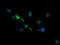 RIO Kinase 2 antibody, NBP2-45960, Novus Biologicals, Immunofluorescence image 