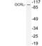 OCRL Inositol Polyphosphate-5-Phosphatase antibody, LS-C177298, Lifespan Biosciences, Western Blot image 