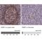 Poly(ADP-Ribose) Polymerase 1 antibody, NBP2-13732, Novus Biologicals, Immunohistochemistry paraffin image 