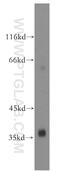 Ubiquitin Specific Peptidase 46 antibody, 13502-1-AP, Proteintech Group, Western Blot image 
