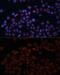 Mitochondrial import receptor subunit TOM70 antibody, GTX32929, GeneTex, Immunocytochemistry image 